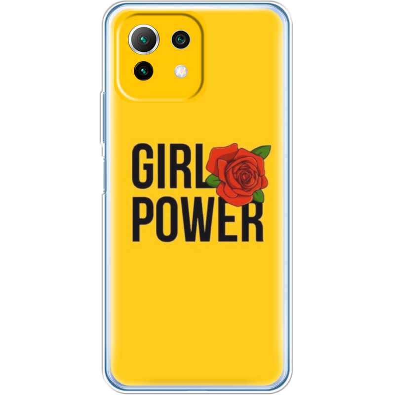 Чехол BoxFace  Xiaomi 11 Lite 5G NE 