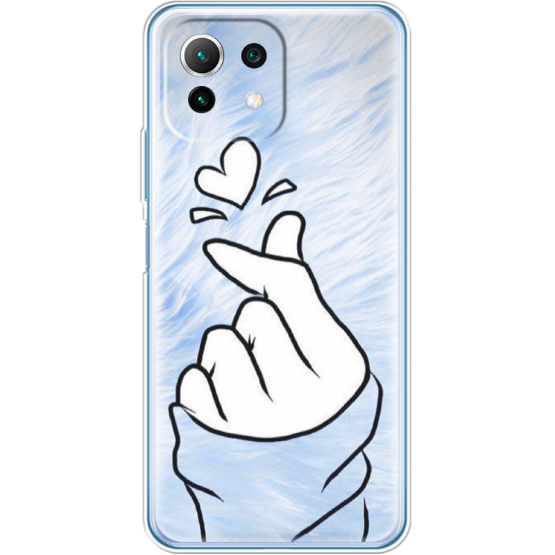 Чехол BoxFace  Xiaomi 11 Lite 5G NE 