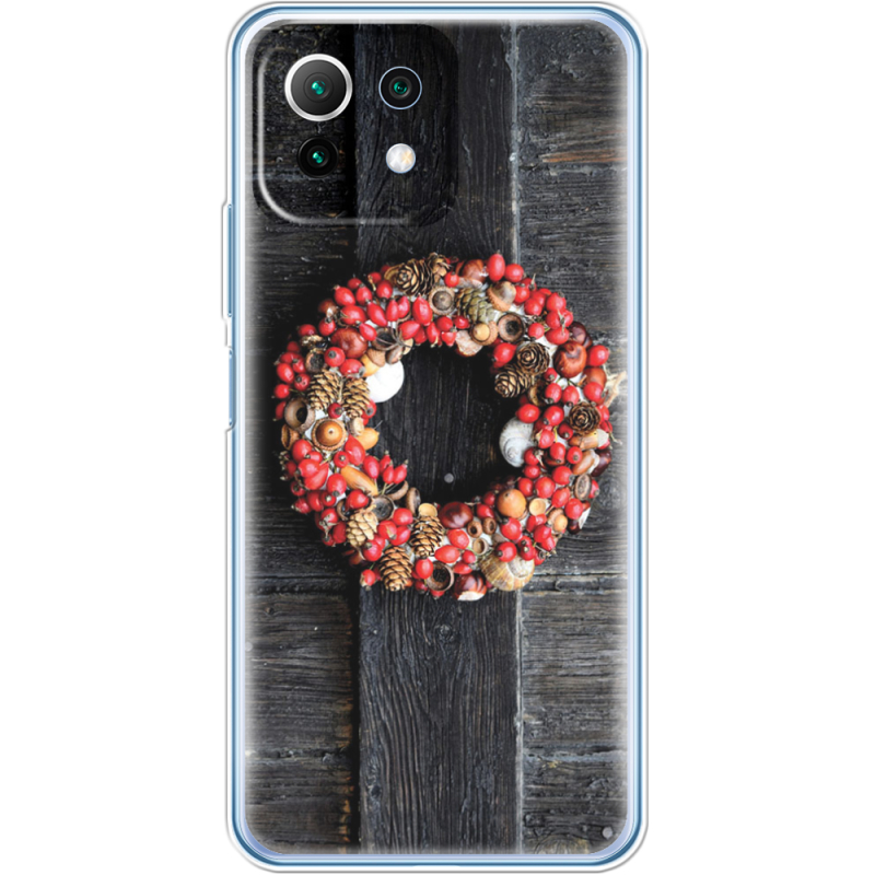 Чехол BoxFace  Xiaomi 11 Lite 5G NE 