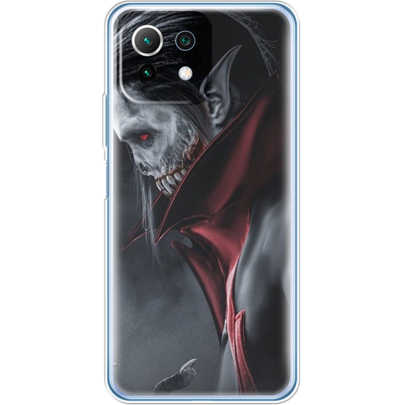 Чехол BoxFace  Xiaomi 11 Lite 5G NE 