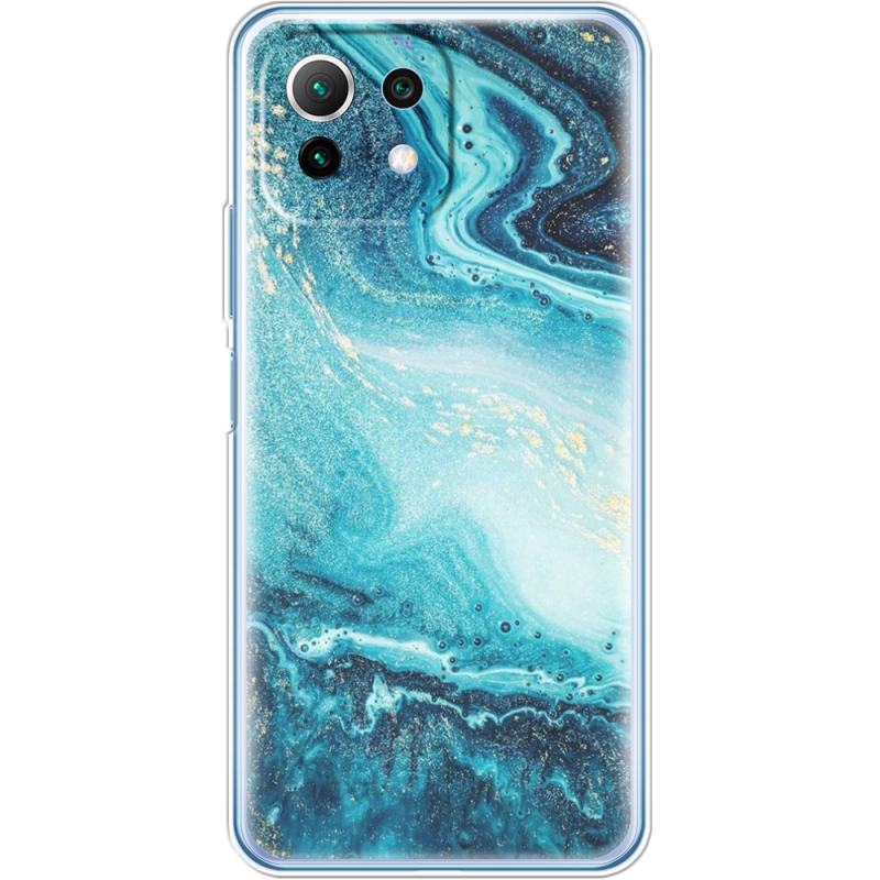 Чехол BoxFace  Xiaomi 11 Lite 5G NE 