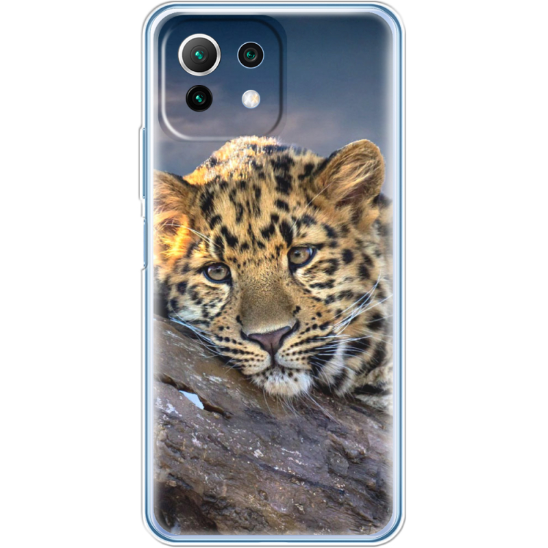 Чехол BoxFace  Xiaomi 11 Lite 5G NE 