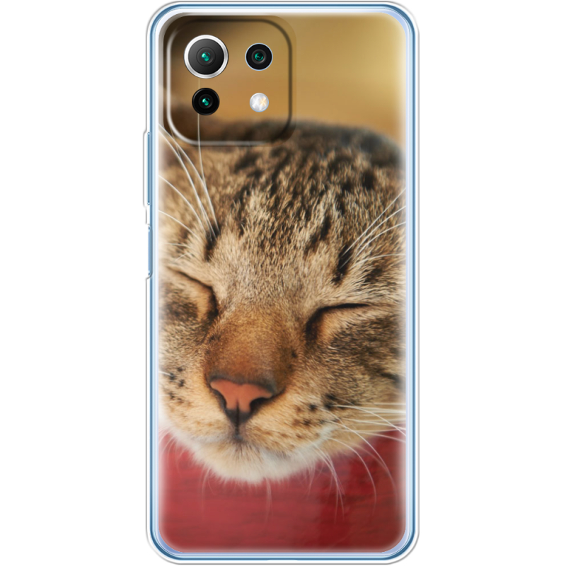 Чехол BoxFace  Xiaomi 11 Lite 5G NE 