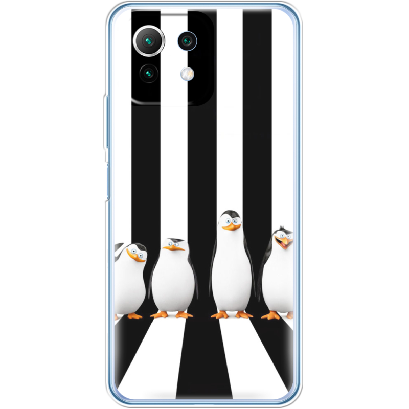 Чехол BoxFace  Xiaomi 11 Lite 5G NE 