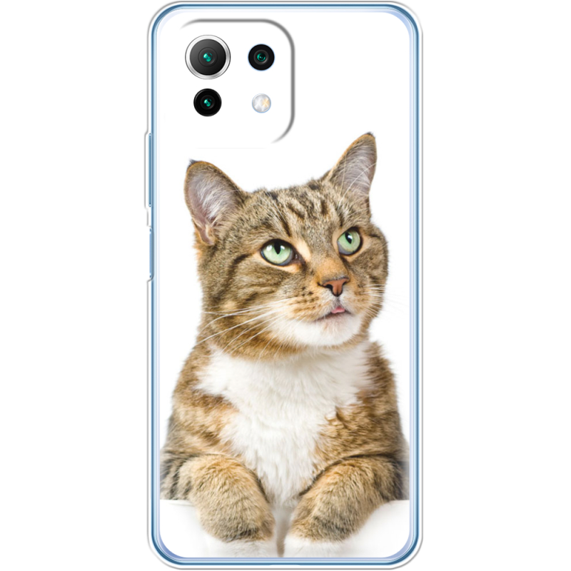 Чехол BoxFace  Xiaomi 11 Lite 5G NE 