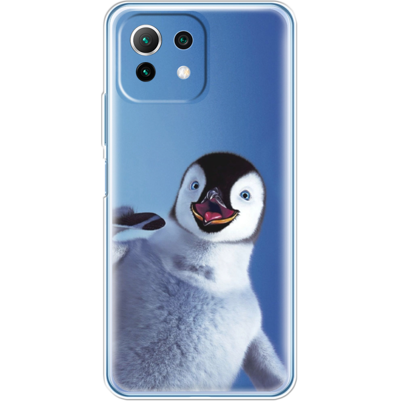 Чехол BoxFace  Xiaomi 11 Lite 5G NE 