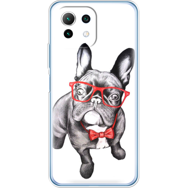 Чехол BoxFace  Xiaomi 11 Lite 5G NE 