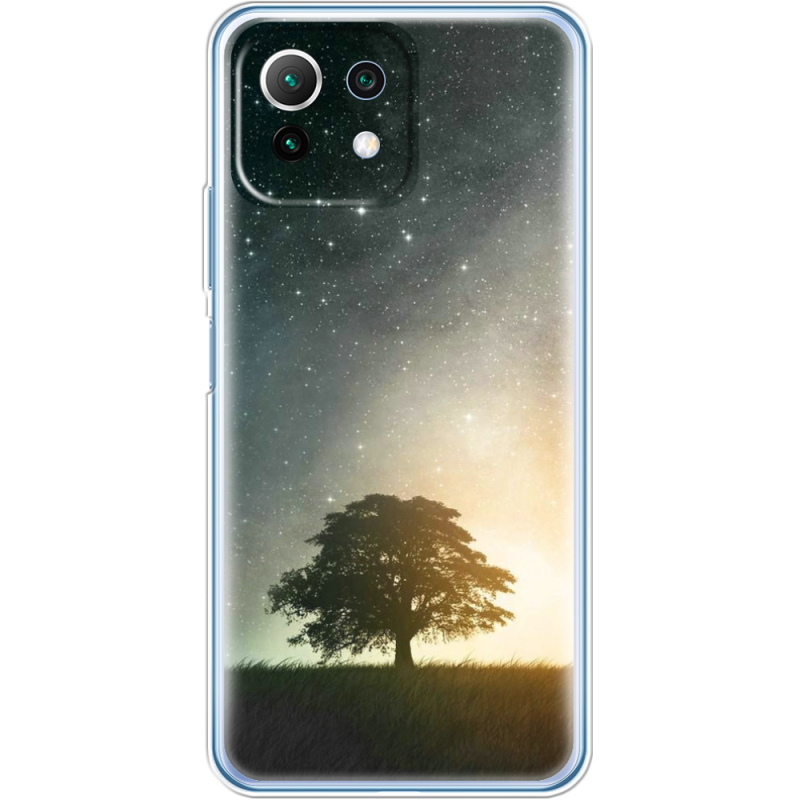 Чехол BoxFace  Xiaomi 11 Lite 5G NE 