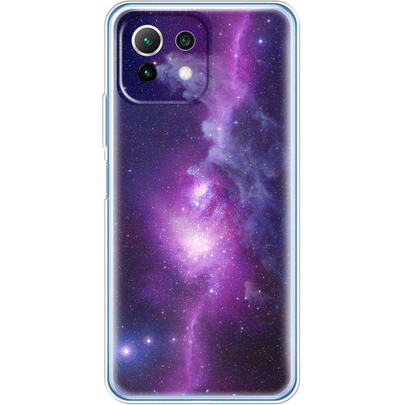 Чехол BoxFace  Xiaomi 11 Lite 5G NE 