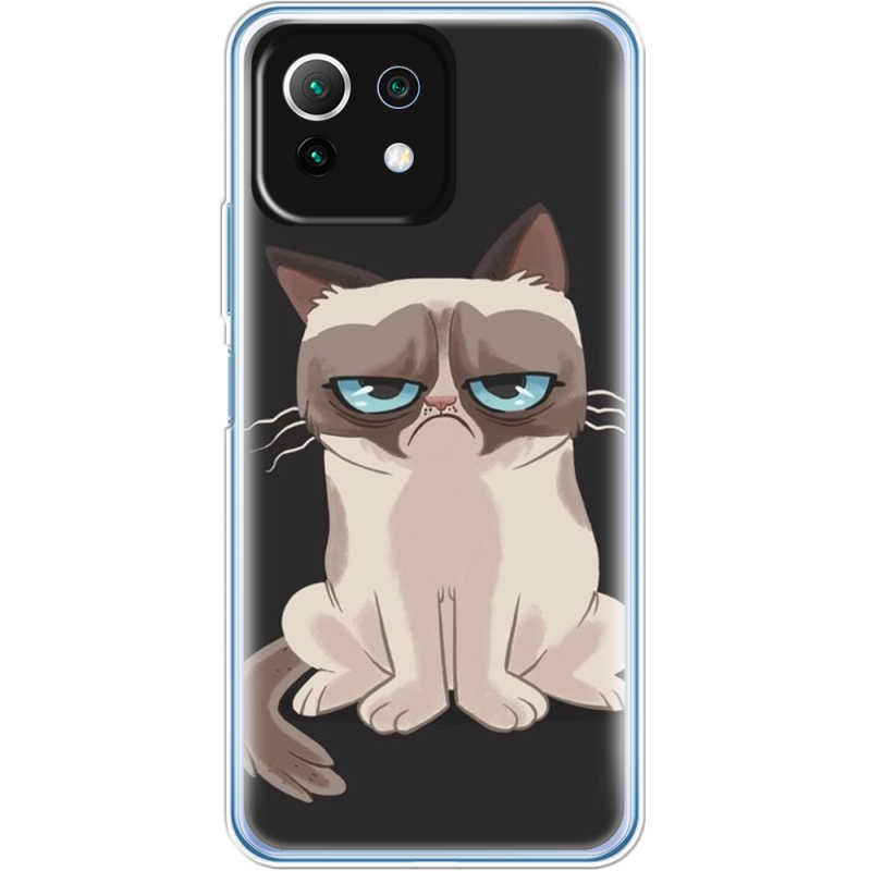 Чехол BoxFace  Xiaomi 11 Lite 5G NE 