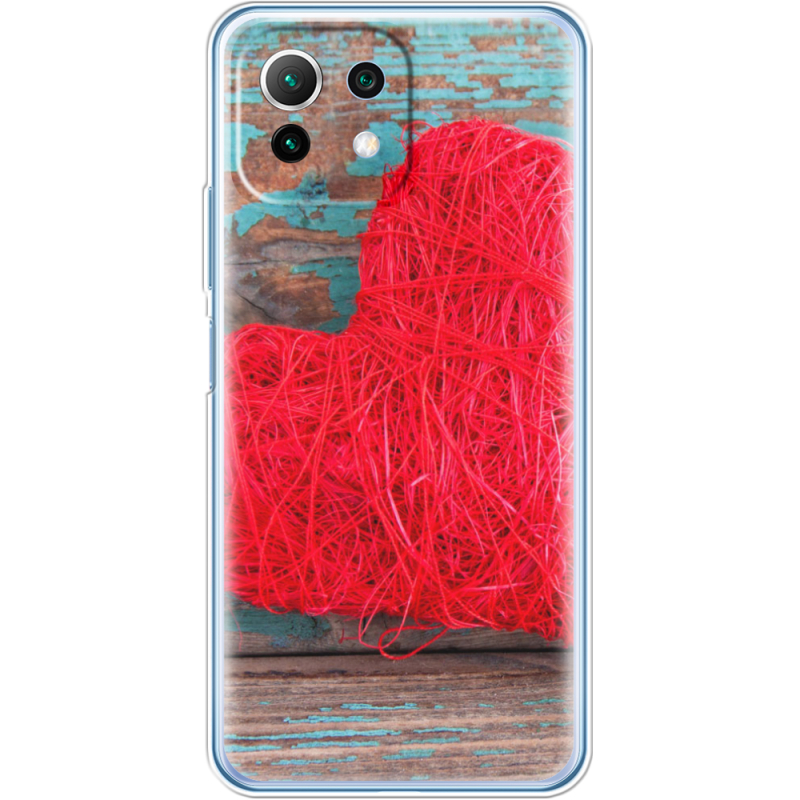 Чехол BoxFace  Xiaomi 11 Lite 5G NE 