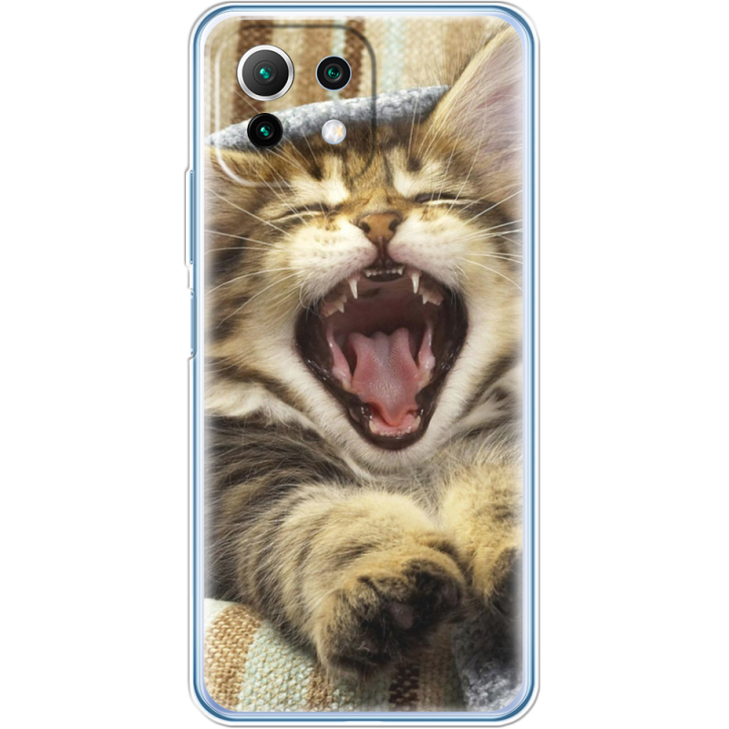 Чехол BoxFace  Xiaomi 11 Lite 5G NE 