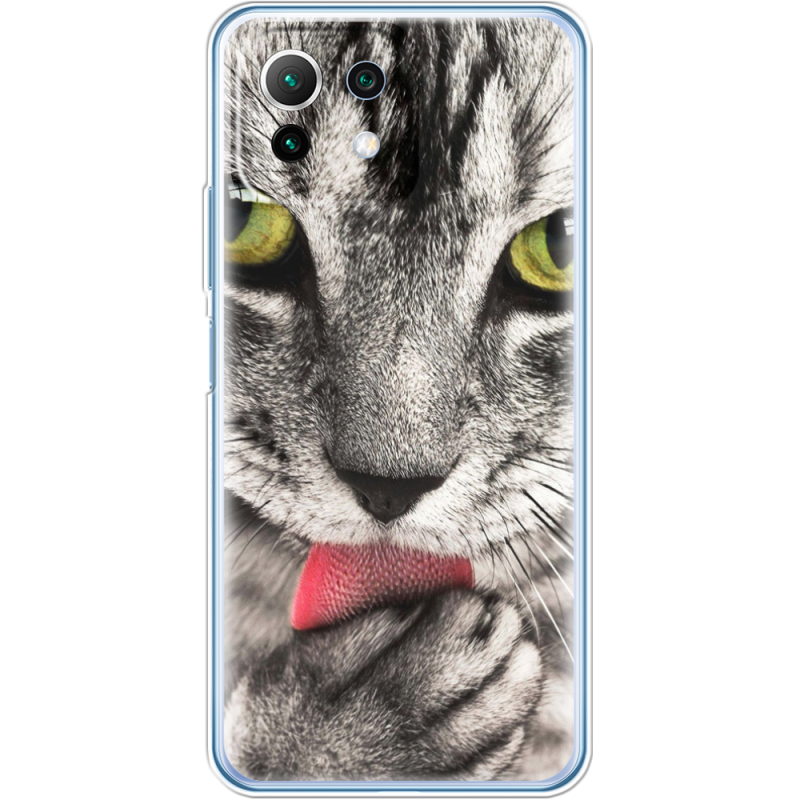 Чехол BoxFace  Xiaomi 11 Lite 5G NE 