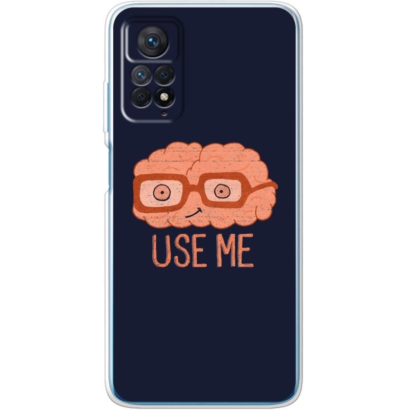 Чехол BoxFace Xiaomi Redmi Note 11 Pro / Note 11 Pro 5G 