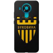 Черный чехол BoxFace Nokia 3.4 