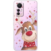 Прозрачный чехол BoxFace Xiaomi 12 Lite Winter Deer