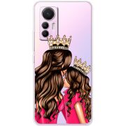 Прозрачный чехол BoxFace Xiaomi 12 Lite Queen and Princess