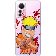 Прозрачный чехол BoxFace Xiaomi 12 Lite Naruto