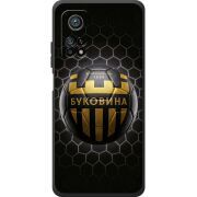 Черный чехол BoxFace Xiaomi Mi 10T / Mi 10T Pro 