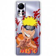 Прозрачный чехол BoxFace Infinix Hot 11S Naruto