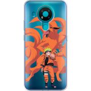 Прозрачный чехол BoxFace Nokia 3.4 Naruto and Kurama