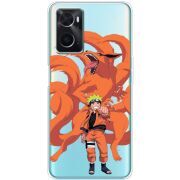 Прозрачный чехол BoxFace OPPO A76 Naruto and Kurama