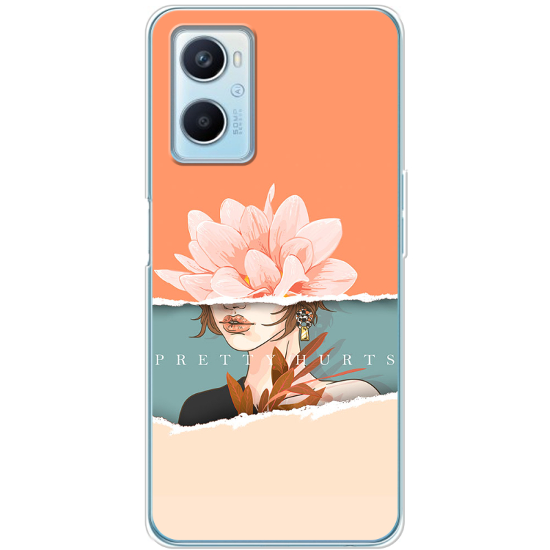 Чехол BoxFace OPPO A96 
