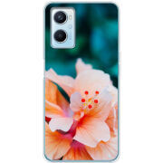 Чехол BoxFace OPPO A96 