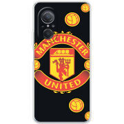 Чехол BoxFace Huawei Nova 9 SE FC Manchester-U