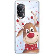 Прозрачный чехол BoxFace Huawei Nova 9 SE Winter Deer