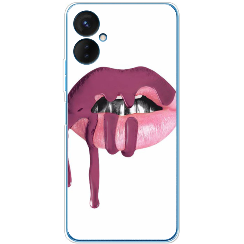 Чехол BoxFace Tecno Spark 9 Pro 