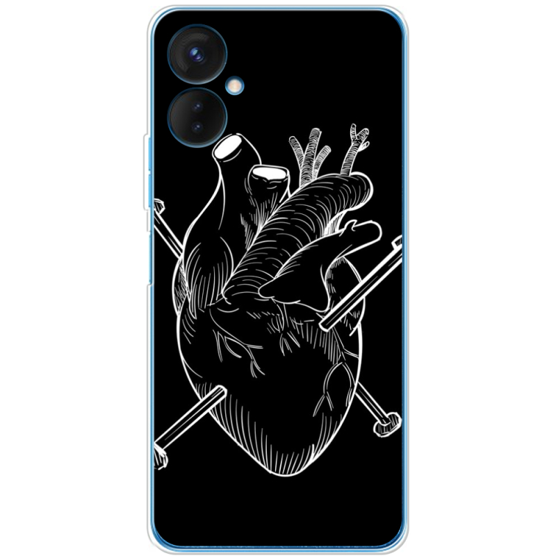 Чехол BoxFace Tecno Spark 9 Pro 