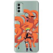 Прозрачный чехол BoxFace Nokia C31 Naruto and Kurama