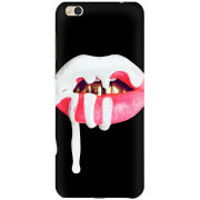 Чехол Uprint Xiaomi Mi5c 