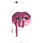 Чехол Uprint Xiaomi Mi5c 