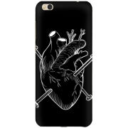 Чехол Uprint Xiaomi Mi5c 