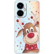 Прозрачный чехол BoxFace Tecno Camon 19 / 19 Pro Winter Deer