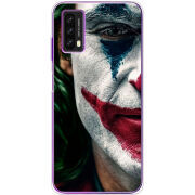 Чехол BoxFace Blackview A90 Joker Background