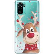 Прозрачный чехол BoxFace Xiaomi Poco M5s Winter Deer