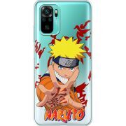 Прозрачный чехол BoxFace Xiaomi Poco M5s Naruto