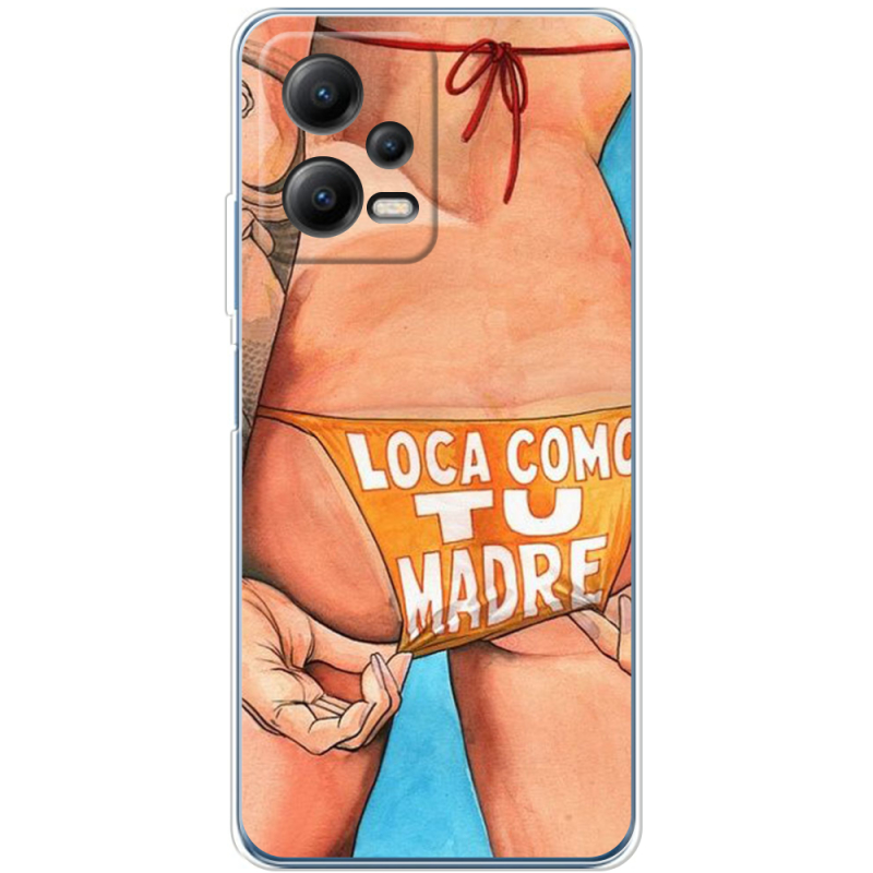 Чехол BoxFace Xiaomi Poco X5 5G 