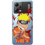 Прозрачный чехол BoxFace Xiaomi Poco X5 5G Naruto