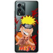 Прозрачный чехол BoxFace ZTE Blade V40 Pro Naruto