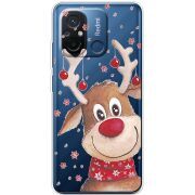 Прозрачный чехол BoxFace Xiaomi Redmi 12C Winter Deer