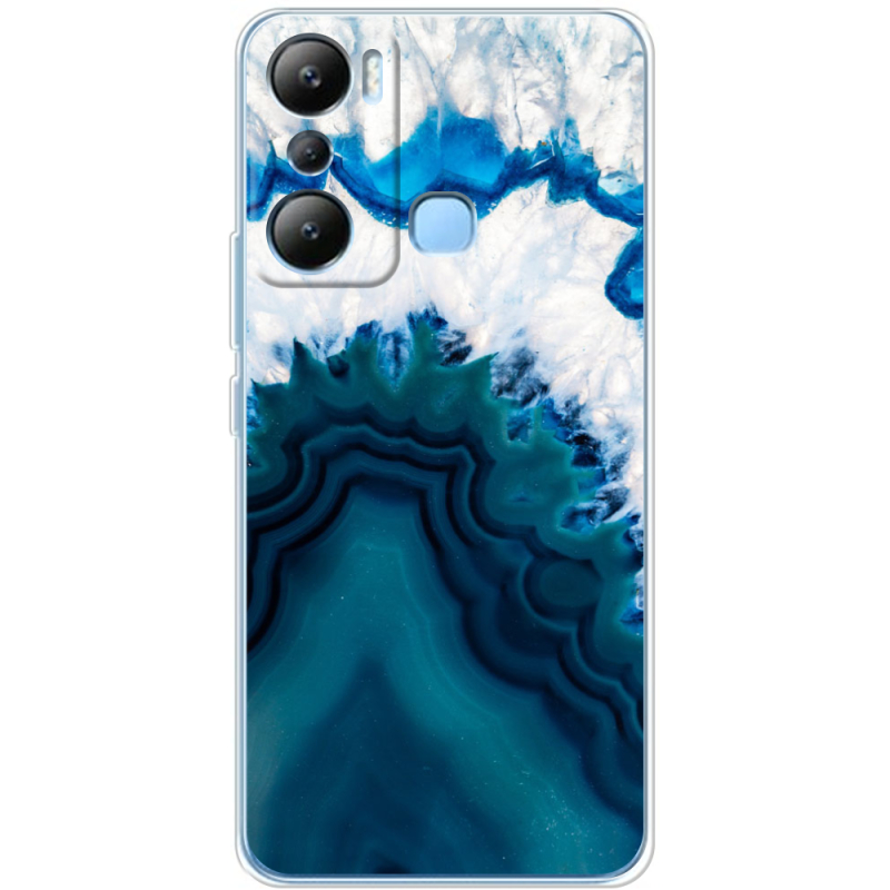 Чехол BoxFace Infinix Hot 20i 