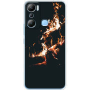 Чехол BoxFace Infinix Hot 20i 