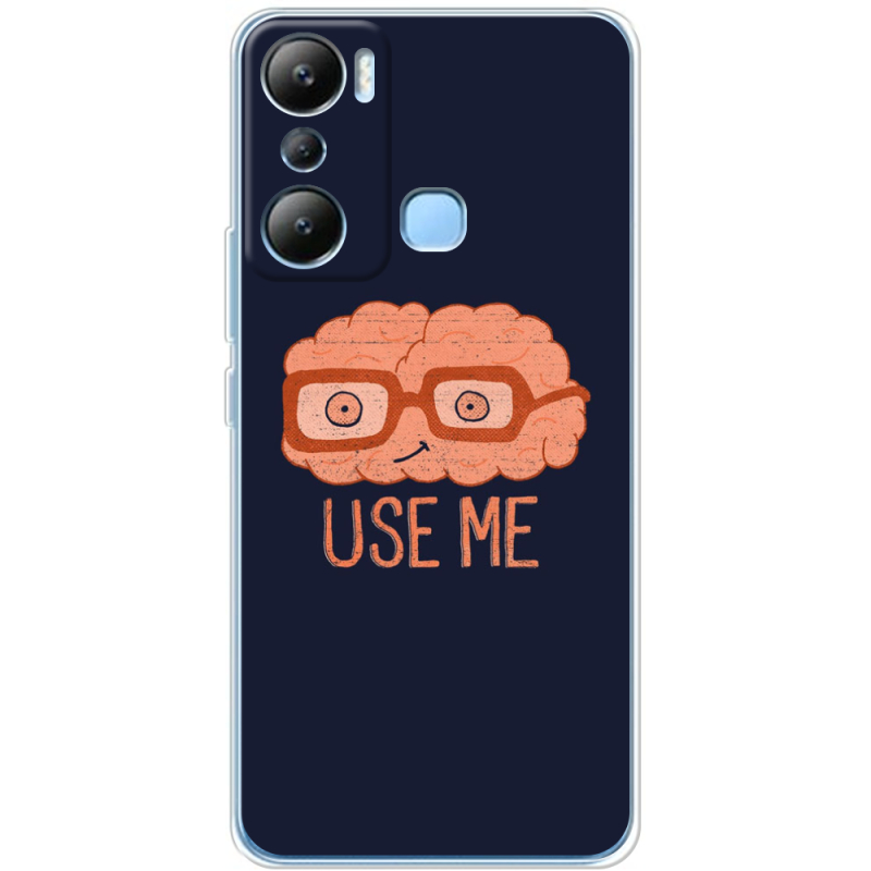 Чехол BoxFace Infinix Hot 20i 