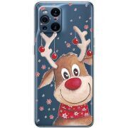 Прозрачный чехол BoxFace OPPO Find X3 Pro Winter Deer