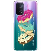 Прозрачный чехол BoxFace OPPO A54 5G Donuts