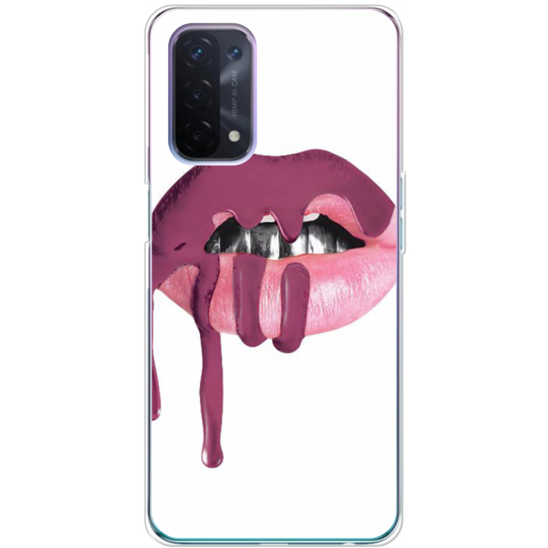 Чехол BoxFace OPPO A74 5G 